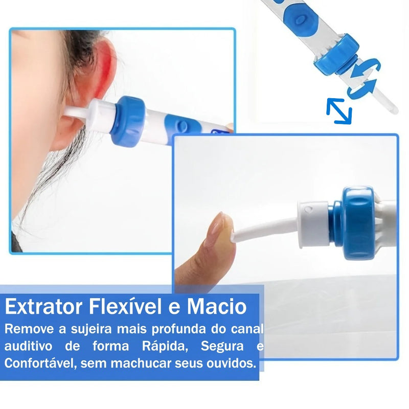 C-ear Limpa ouvidos elétrico sem fio, vibração segura e indolor, conjunto sugador de limpeza de ouvidos de silicone, remoção de cera para crianças e adultos